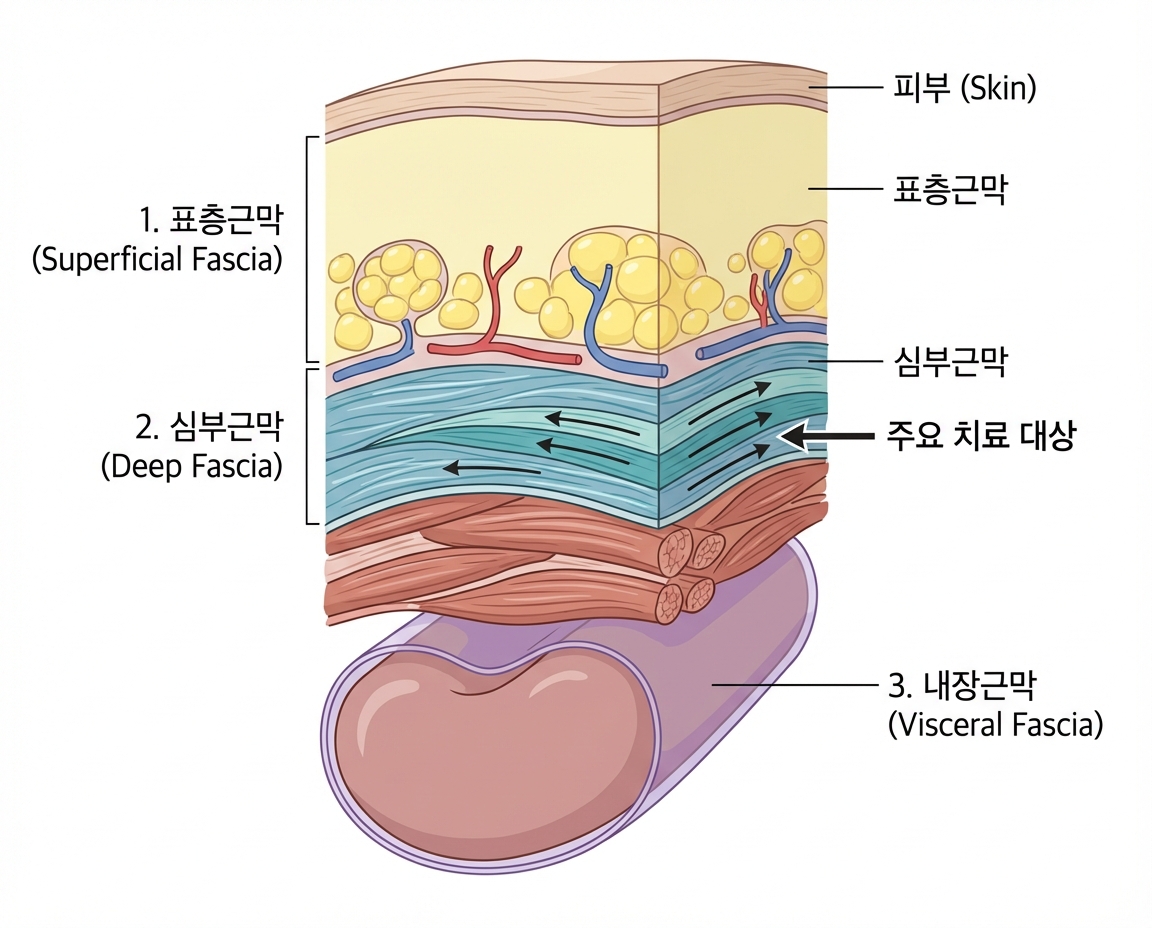 근막 3층 구조 — 표층·심부·내장